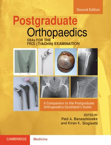 SBAs for the FRCS (Tr&Orth) Examination: A Companion to the Postgraduate Orthopaedics Candidate's Guide
