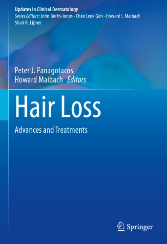 Hair Loss: Advances and Treatments
