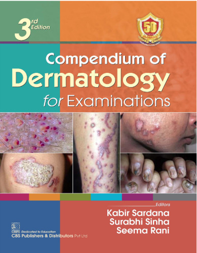 Compendium of Dermatology for Examinations