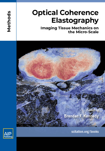 Optical Coherence Elastography: Imaging Tissue Mechanics on the Micro-Scale