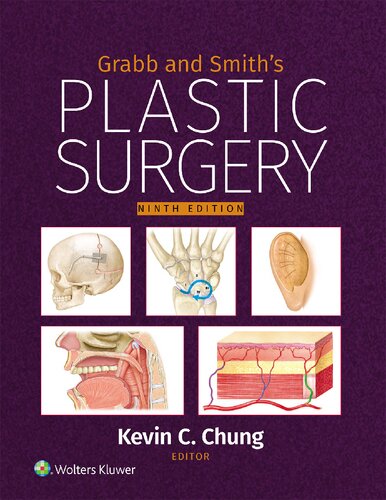 Grabb and Smith's Plastic Surgery