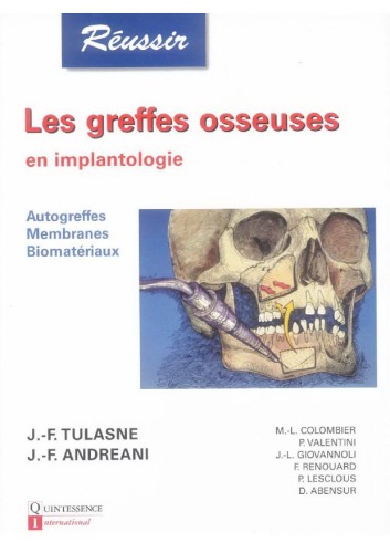 Les greffes osseuses en implantologie  French