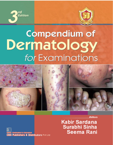 Compendium of Dermatology for Examinations