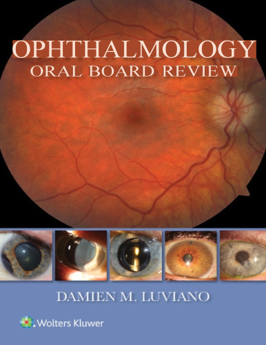 Ophthalmology Oral Board Review