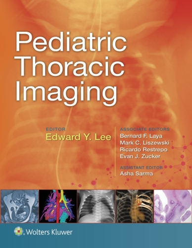 Pediatric Thoracic Imaging (Nov 22, 2018)_(1496356233)_(LWW).epub