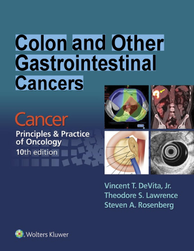 Colon and Other Gastrointestinal Cancers - Cancer - Principles & Practice of Oncology, 10e (May 26, 2016)_(1496333969)_(LWW).pdf