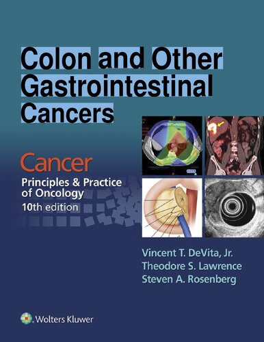 Colon and Other Gastrointestinal Cancers - Cancer - Principles & Practice of Oncology, 10e (May 26, 2016)_(1496333969)_(LWW)