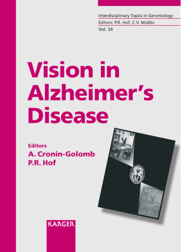 Vision In Alzheimer's Disease