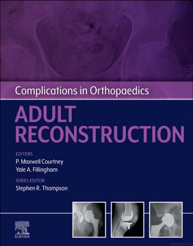 Complications in Orthopaedics: Adult Reconstruction