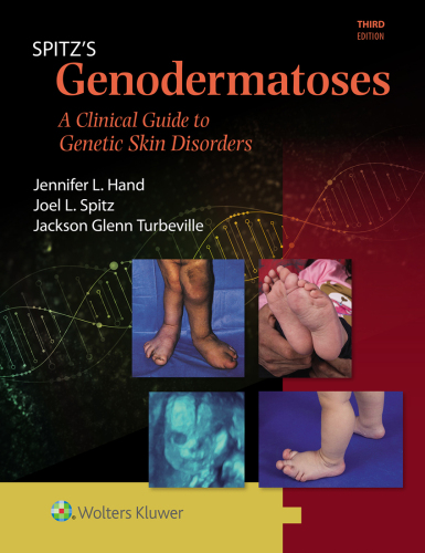 Spitz’s Genodermatoses
