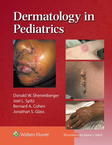 Dermatology in Pediatrics (Aug 7, 2024)_(197523538X)_(LWW).epub