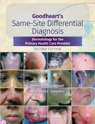 Goodheart's Same-Site Differential Diagnosis: Dermatology for the Primary Health Care Provider