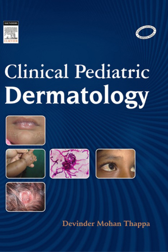 Clinical Pediatric Dermatology