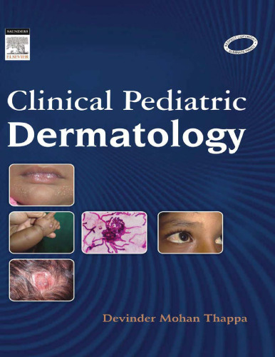 Clinical Pediatric Dermatology