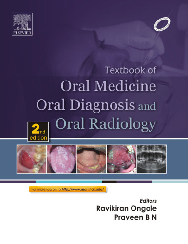 Textbook of Oral Medicine Oral Diagnosis and Oral Radiology
