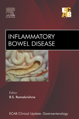 ECAB Inflammatory Bowel Disease