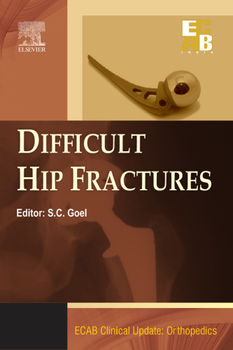 ECAB Difficult Hip Fracture