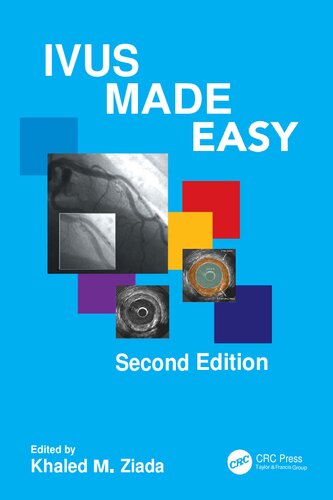 IVUS Made Easy, 2e (Mar 3, 2025)_(1032262265)_(CRC Press).pdf
