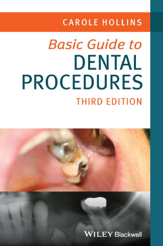 Basic Guide to Dental Procedures (Basic Guide Dentistry Series)