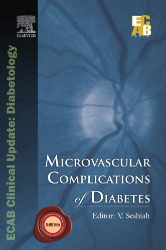 Microvascular Complications of Diabetes - ECAB