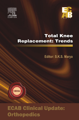 Total Knee Replacement: Trends - ECAB