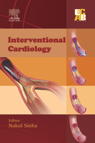 Interventional Cardiology - ECAB