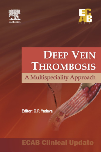 Deep Vein Thrombosis - ECAB