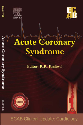 Acute Coronary Syndrome - ECAB