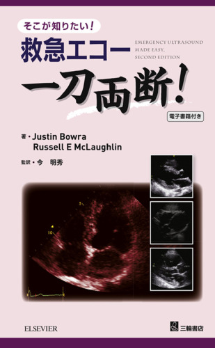 そこが知りたい！ 救急エコー 一刀両断！