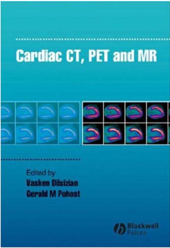 Cardiac CT, PET and MR