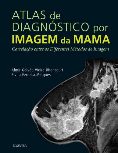 Atlas de Diagnóstico por Imagem de Mama: Correlação entre os Diferentes Métodos de Imagem