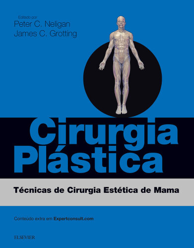 Cirurgia Plástica: Técnicas de Cirurgia Estética de Mama 3ED: Técnicas de Cirurgia Estética de Mama