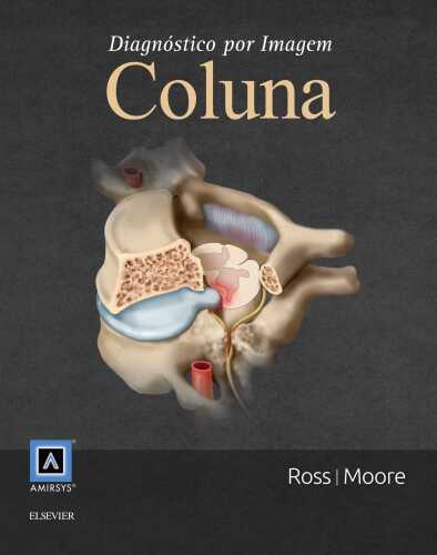 Diagnóstico por Imagem: Coluna 3ED: Tradução da 3ª edição