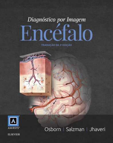 Diagnóstico por Imagem: Encéfalo 1ED