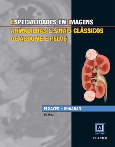 Especialidades em Imagens 1ED: Armadilhas e Sinais Clássicos de Abdome e Pelve
