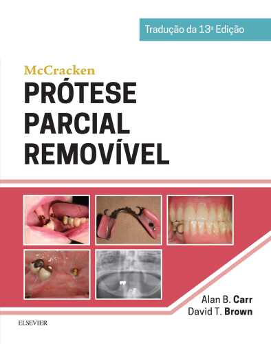 McCracken Prótese Parcial Removível 13ED