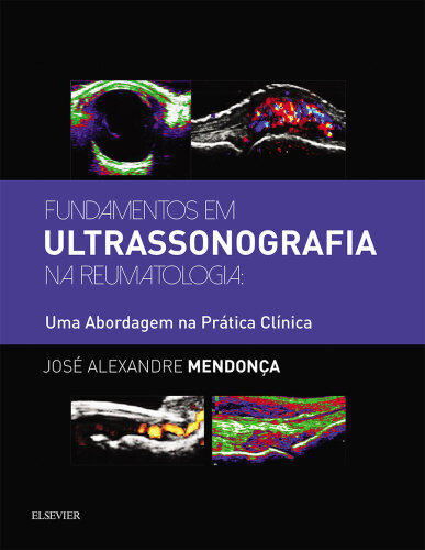 Fundamentos em Ultrassonografia na Reumatologia 1ED