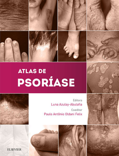 Atlas de Psoríase 1ED