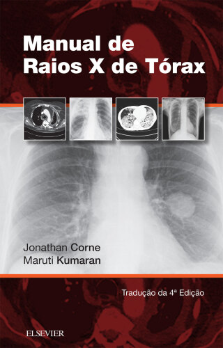 Manual de Raios-X de Tórax 4ED