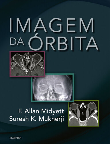 Imagem da Órbita 1ED