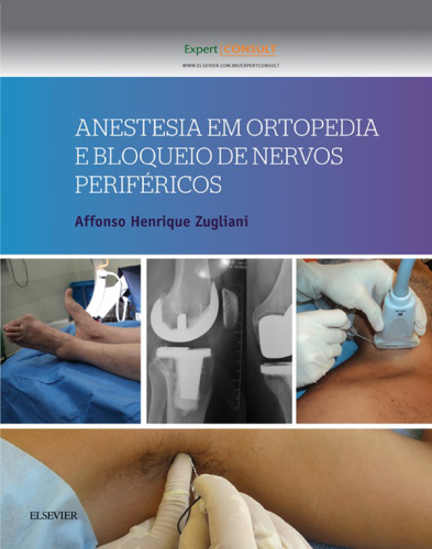 Anestesia em Ortopedia e Bloqueio de Nervos Periféricos 1ED