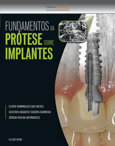 Fundamentos da Prótese Sobre Implantes 1ED
