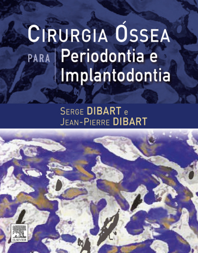Cirurgia Óssea para Periodontia e Implantodontia 1ED