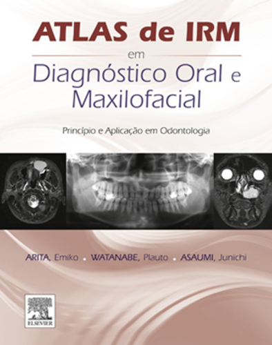 Atlas de IRM em Diagnostico Oral e Maxilofacial 1ED: Principio e Aplicação em Odontologia