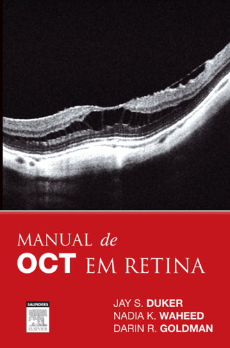 Manual de OCT em Retina 1ED