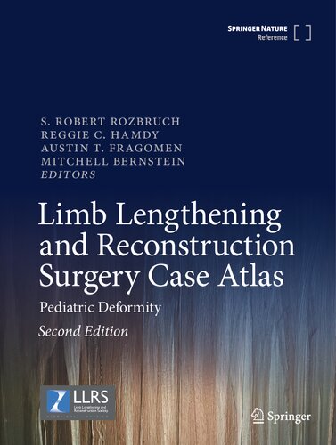 Limb Lengthening and Reconstruction Surgery Case Atlas: Pediatric Deformity