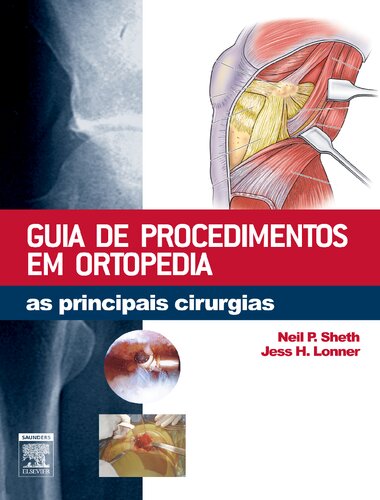 Guia De Procedimentos Em Ortopedia 1ED: As Principais Cirurgias