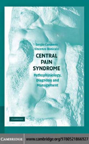 Central Pain Syndrome: Pathophysiology, diagnosis and management