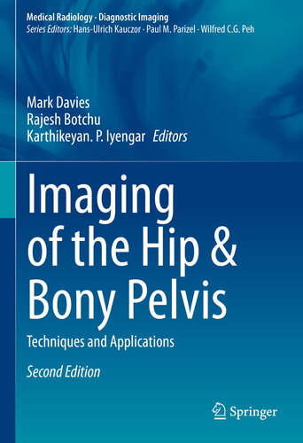 Imaging of the Hip & Bony Pelvis: Techniques and Applications, Second Edition