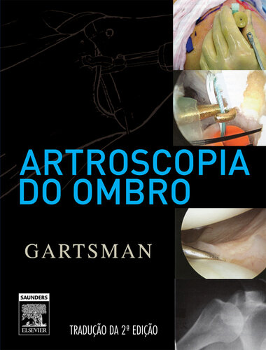 Artroscopia Do Ombro 2ED